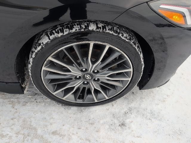 2017 Hyundai Elantra Sport