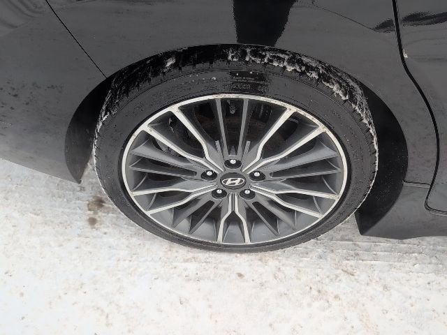 2017 Hyundai Elantra Sport