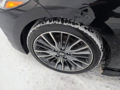 2017 Hyundai Elantra Sport