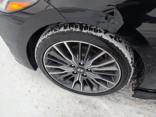 2017 Hyundai Elantra Sport