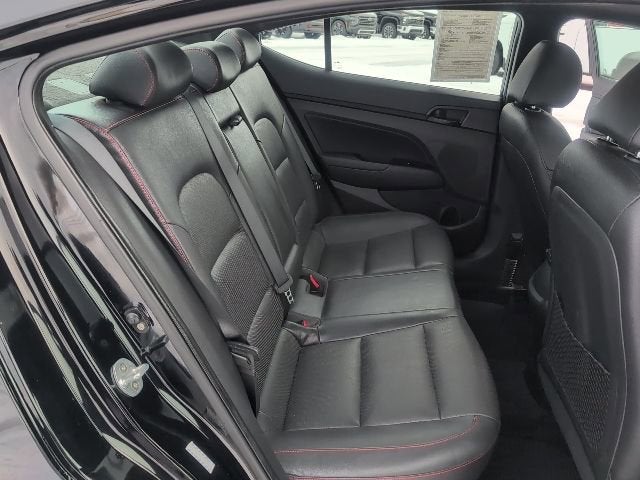 2017 Hyundai Elantra Sport