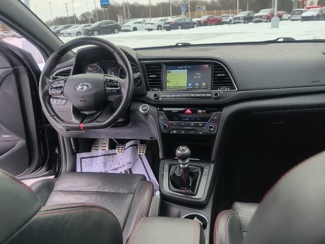 2017 Hyundai Elantra Sport